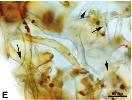High magnification of dinosaur vessels shows branching pattern (arrows) and round, red microstructures in the vessels. Source: Schweitzer, et al., “Soft-Tissue Vessels and Cellular Preservation in Tyrannosaurus rex”, Science, 307 (2005) 1952 [6].